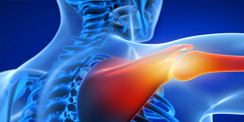 Omuz Cerrahisi 800X400 bannerR